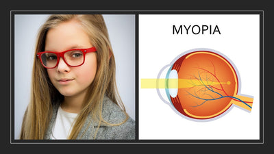 Myopia - The Silent Pandemic
